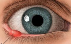 गर्भावस्था के दौरान आंख पर जौ के लिए स्वीकार्य दवाएं