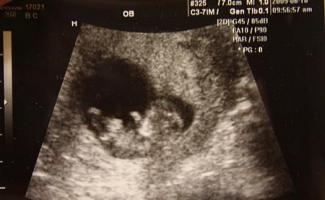 Onzième semaine de grossesse - qu'arrive-t-il au bébé, photo du fœtus, sensations