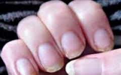 Les secrets d'une bonne manucure : que faire si les ongles exfolient ?