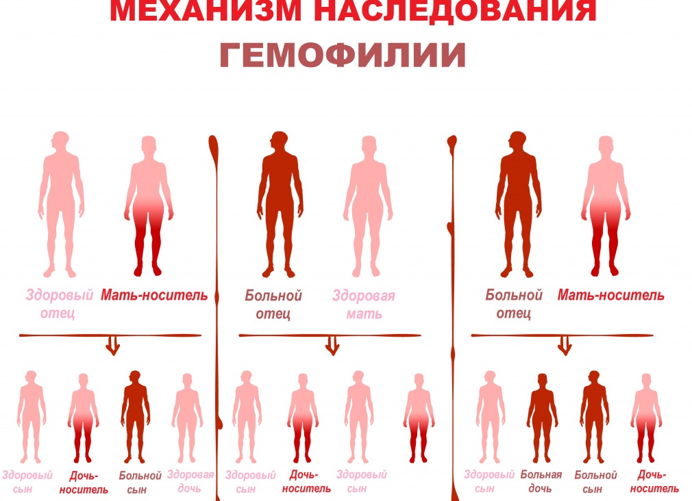 Что такое эмофилия и как с ней справиться